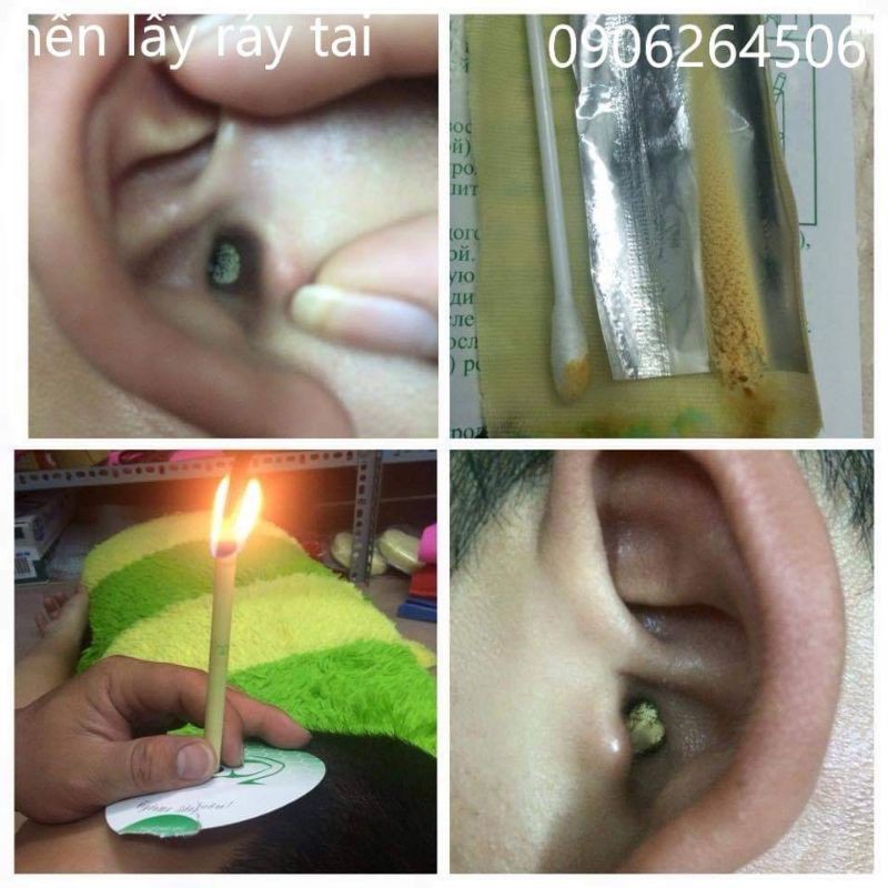 Cây Lấy Ráy Tai Có Đèn Thiết Kế Thông Minh Phù Hợp Với Người Lớn Và Trẻ Con