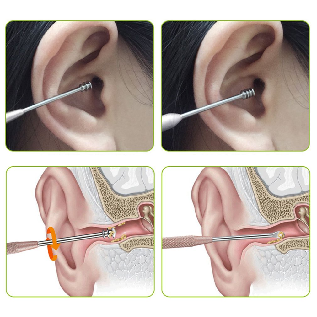 Muỗng Lấy Ráy Tai Hai Mặt Bằng Thép Không Gỉ Tiện Dụng