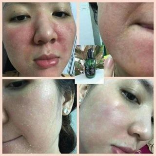 Thay da nhân sâm Mqskin