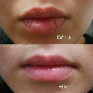 Son dưỡng môi lô hội 92% ( dùng thích)