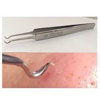 NHÍP GẮP MỤN THẦN THÁNH
