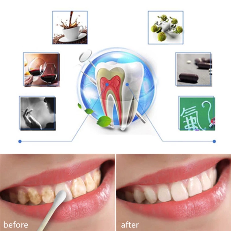 Bột Làm Trắng Răng Chất Lượng Cao