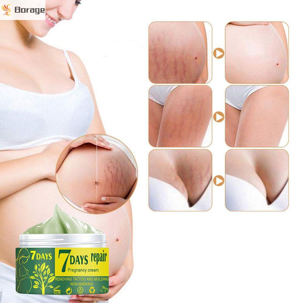 Kem Hỗ trợ giảm sẹo chăm sóc da BORAGE cho phụ nữ mang thai