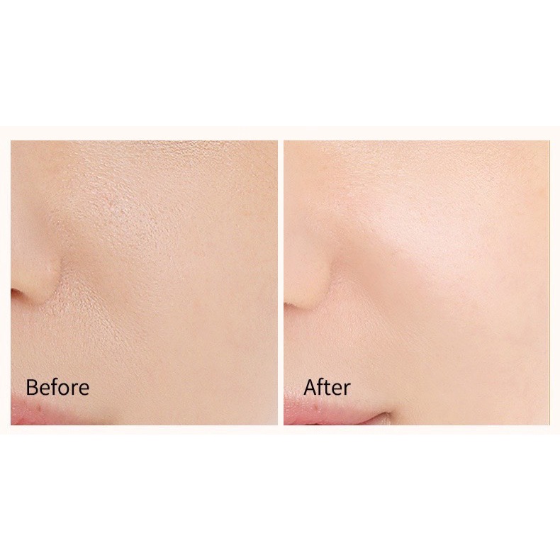 Tinh Chất Vitamin C đồng thời chứa chiết xuất cam thảo giúp Sáng Da Mờ Thâm mụn vào cải thiện sẹo thâm