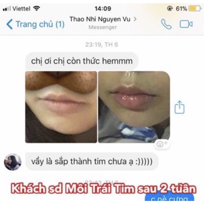 Tinh chất Miracle Pháp tạo môi trái tim và làm dầy môi sexy (10ml)