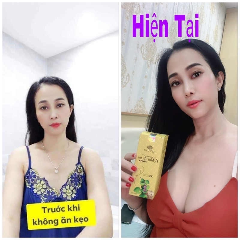 Combo 5h Kẹo mầm sâm Tố Nữ và Kem Massa Nở ngực siêu tốc Thảo Mộc 37