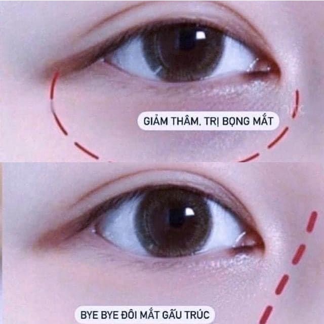 Kem Dưỡng Mắt AHC Youth Lasting Real Eye Cream GentsOfficialStore