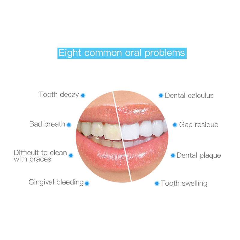 Máy tăm nước CKEYIN chăm sóc răng miệng sạc lại được tiện lợi
