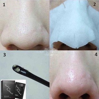 ( Hộp 20 miếng) MẶT NẠ LỘT MỤN ĐẦU ĐEN GOODBYE BLACKHEAD