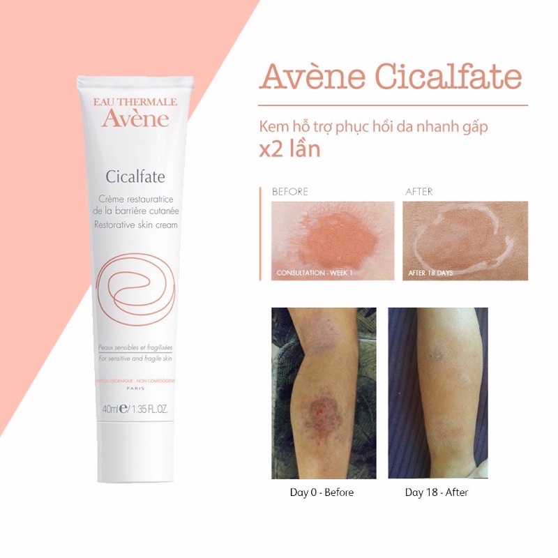 KEM DƯỠNG PHỤC HỒI DA AVÈNE CICFATE PHÁP 40ml