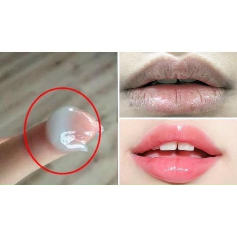 ❤️ SON DƯỠNG MÔI BLISTEX LIP MEDEX