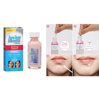 CHẤM XẸP MỤN BYE BYE BLEMISH DRYING LOTION