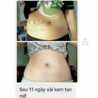Kem tan mỡ gừng gừng ớt ngân bình