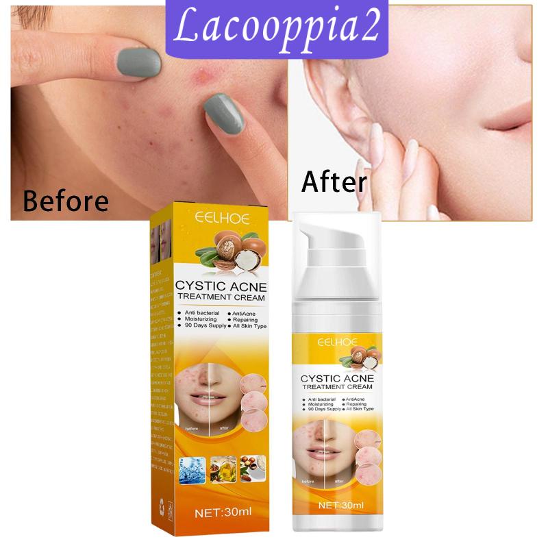 Kem Trị Mụn Lacooppia2 Làm Sáng Da Dịu Nhẹ