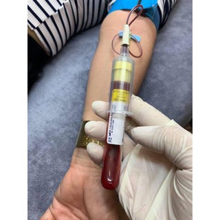 Ống ACD lấy máu chân không làm PRP