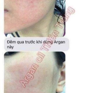 Argan oil cấp ẩm dưỡng da