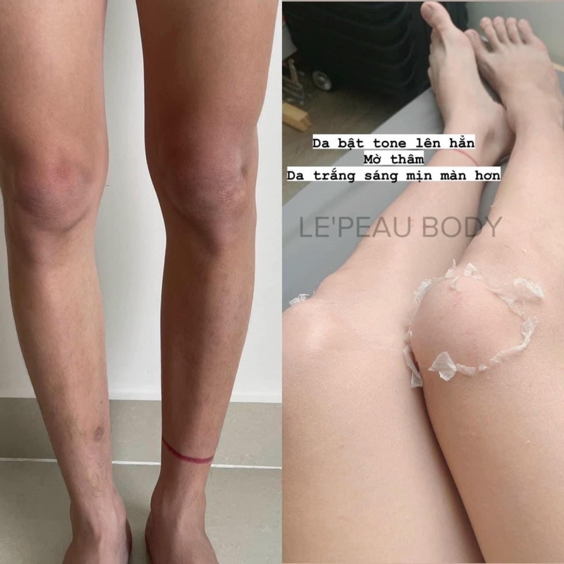 Peel nách retinol, peel body Le'peau trắng da mờ thâm sau 7 ngày tặng kem dưỡng ẩm - LEPEAU VIETNAM