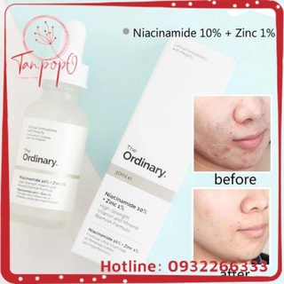 Tinh chất giảm mụn thâm The Ordinary Niacinamide 10% + Zinc 1% 30ml
