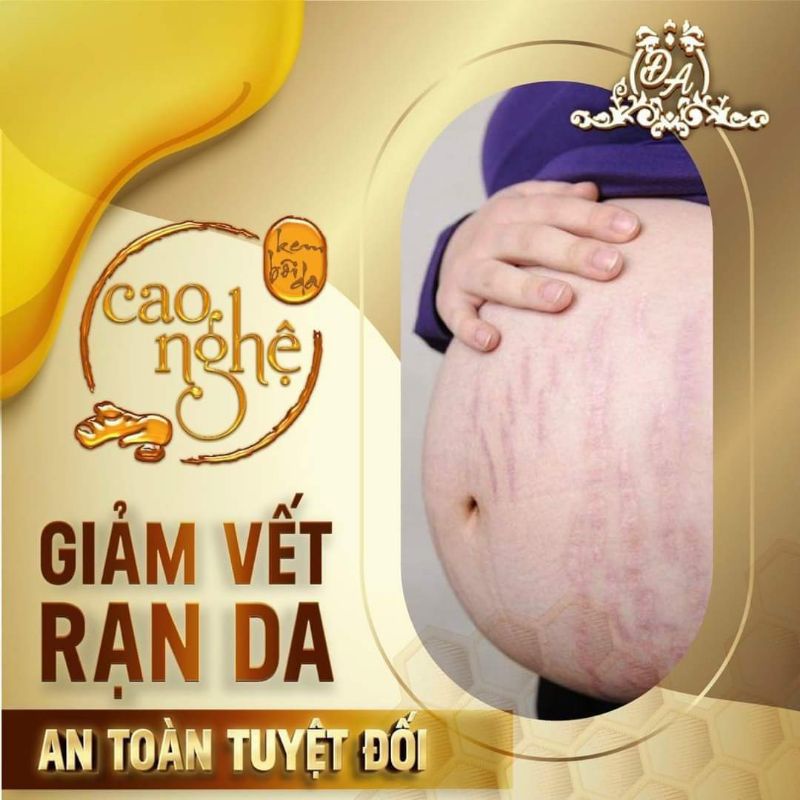Cao Nghệ Collagen X3 Đông Anh dưỡng sáng da, làm mờ các vết thâm, nám, vết thâm seo mụn