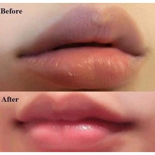 Tẩy Tế Bào Chết Môi Beauty Treats Lip Scrub 10.5gram LINACOS | BigBuy360 - bigbuy360.vn
