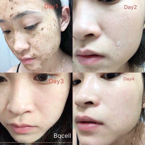 Vi Tảo Thay Da Sinh Học QSCELL số 1 Hàn Quốc