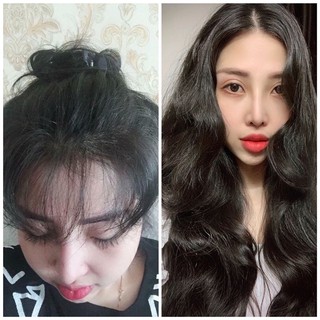 xịt mọc tóc Y lang mọc tóc dài nhanh