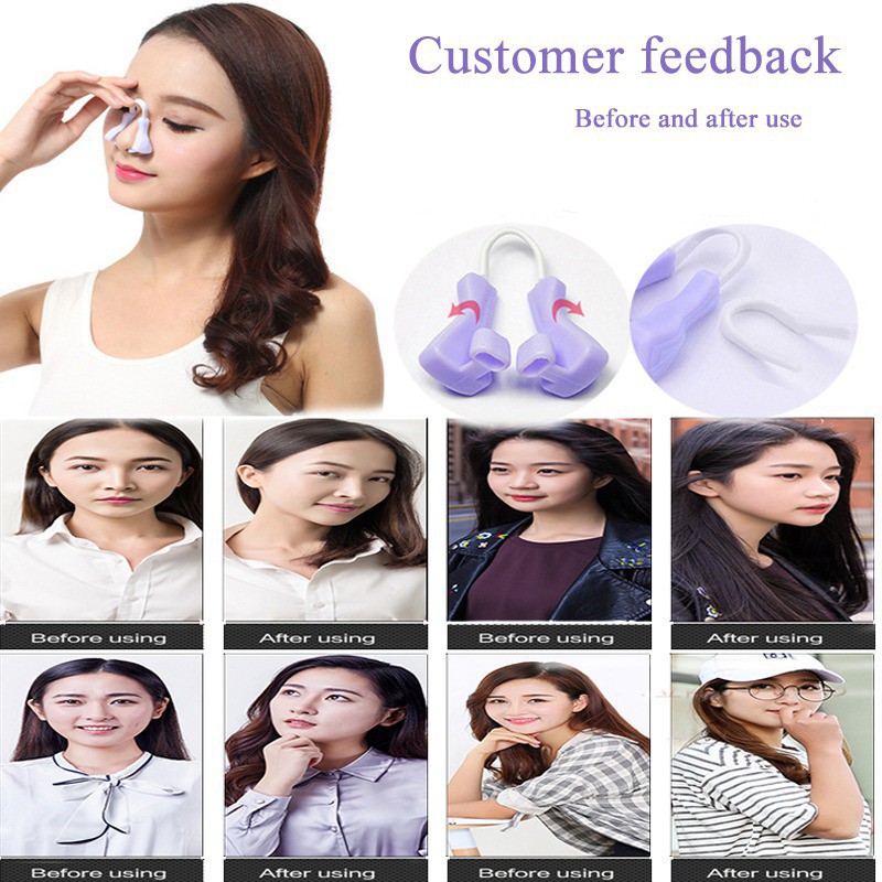 Dụng cụ kẹp định hình sống mũi