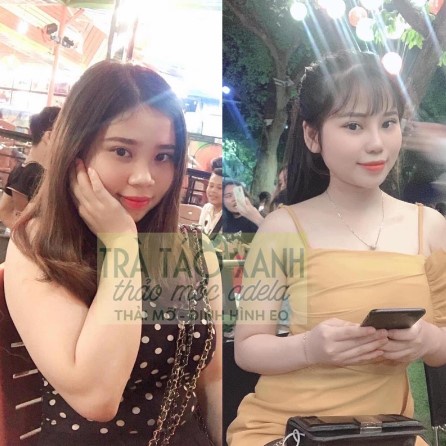Trà Táo Xanh Giảm Cân Kelly Thảo Mộc Adela Detox Hộp 12 Gói Giảm Mỡ Bụng Cấp Tốc An Toàn Kiểm Soát Cân Nặng