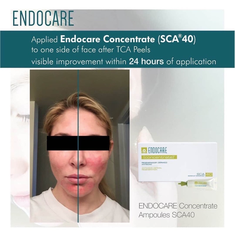 Endocare Concentrate SCA40 tinh chất phục hồi lão hoá làm đẹp da (1ml.7 Ống)