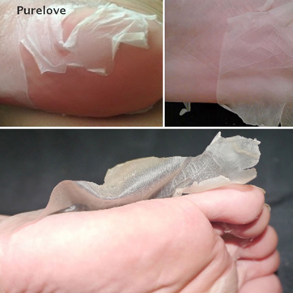 (Hàng Mới Về) Dụng Cụ Lột Da Chết Cho Bàn Chân