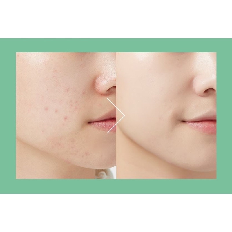 Phấn nước A’pieu Wonder Tension Pact (refill) | BigBuy360 - bigbuy360.vn