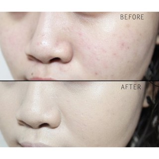 Phấn Nước Trang Điểm Dưỡng Da Mộc An