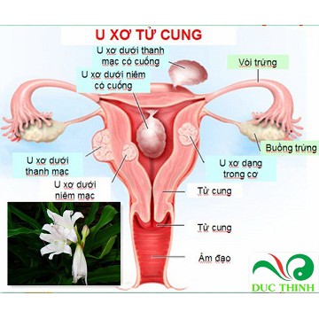 trinh nữ hoang cung trị u nang u xơ💖FREESHIP💖trinh nữ hoang cung cao xạ đen sản xuất tại việt nam LT669999