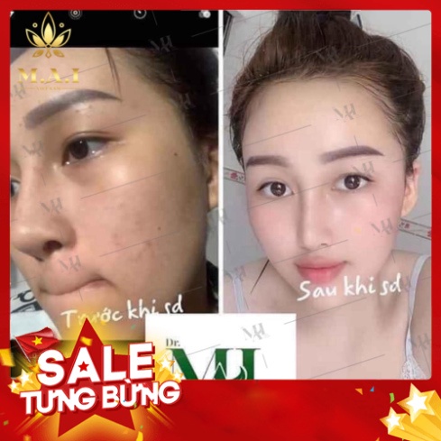 Combo tri mun Dr mai [CHÍNH HÃNG] ✅