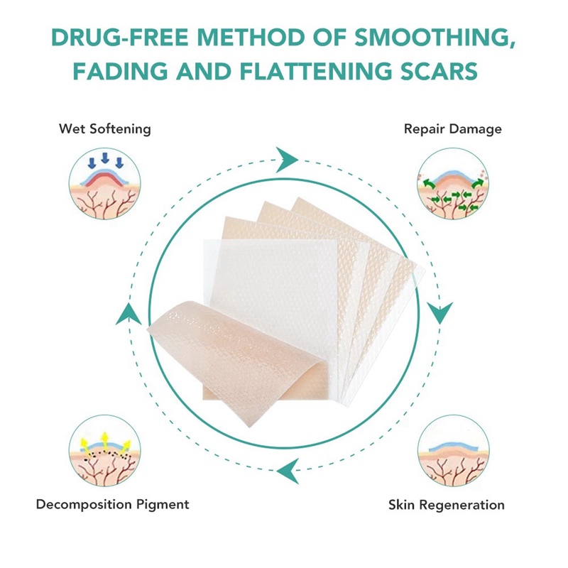 Set 3 Miếng Dán Silicone Hỗ Trợ Giảm Sẹo Mụn Hiệu Quả