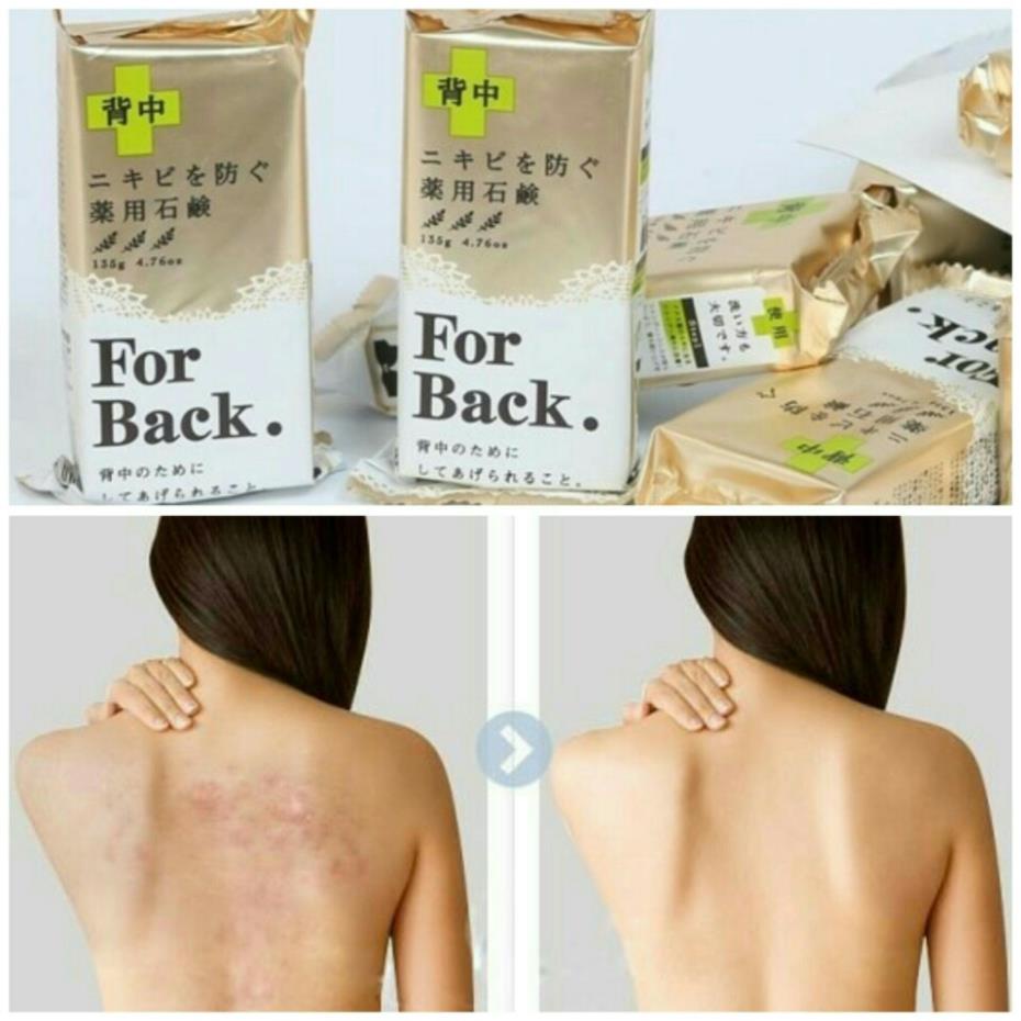 Xà Phòng Mụn Lưng For Back Pelican Nhật 135gr - Xà Bông Giảm Mụn Body Chỉ Sau 14 Ngày