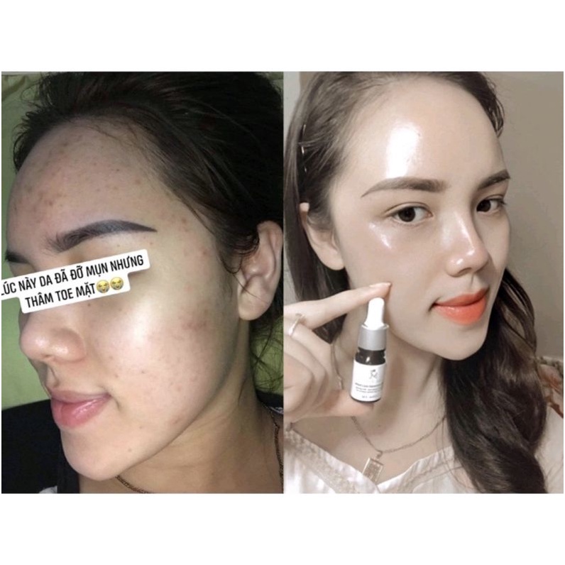 ⭐Serum mộc       tuyết date mới nhất⭐