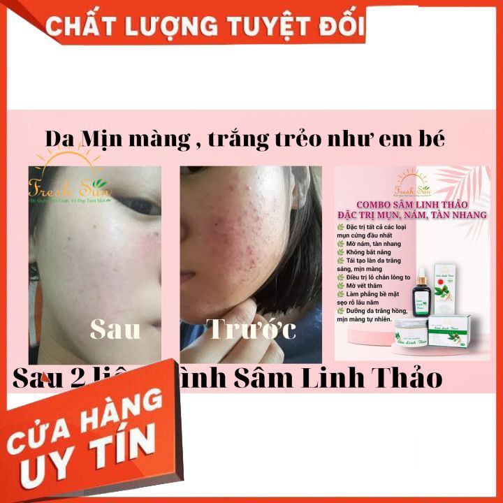 Sâm Linh Thảo [CHÍNH HÃNG] 💞 Đánh bay các loại MỤN, nám, tàn nhang