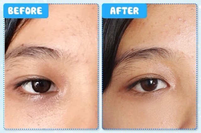 (Phiên bản mới nhất 2018) Kem dưỡng mắt ESTEE LAUDER Advanced Night Repair Eye MINISIZE (3ML-5ML) | BigBuy360 - bigbuy360.vn