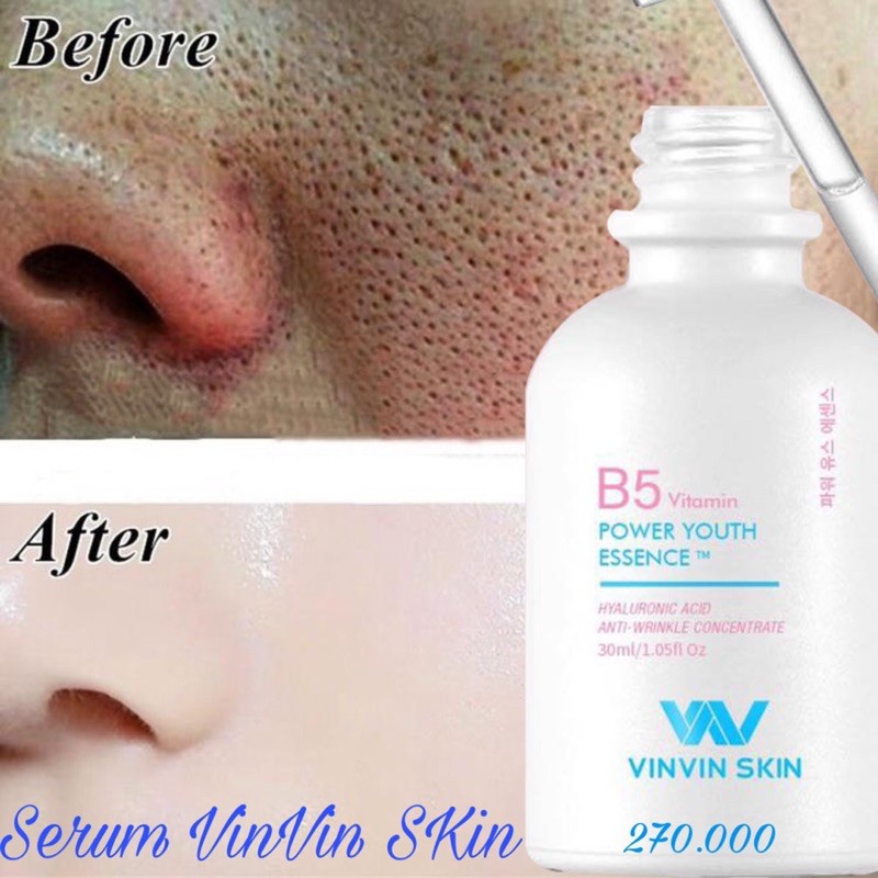[FREESHIP] Serum dưỡng trắng da, căng bóng nhờ dịch yến tươi | BigBuy360 - bigbuy360.vn