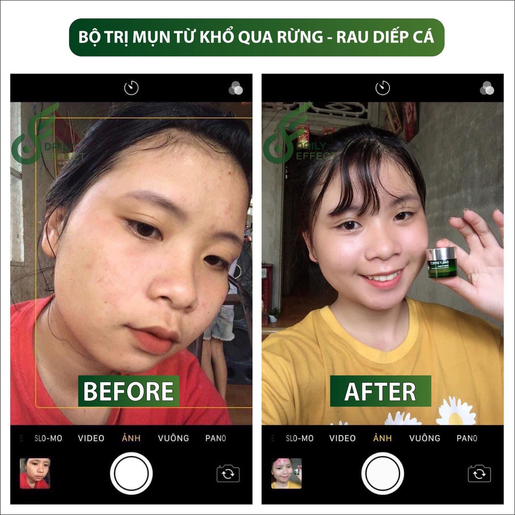 Kem chấm mụn Daily Effect🌿 | BigBuy360 - bigbuy360.vn