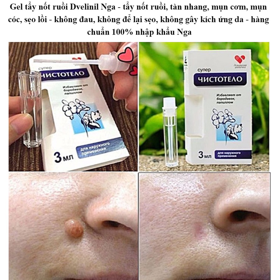Gel chấm tẩy nốt ruồi mụn cóc tàn nhang hiệu quả DVELINIL của Nga