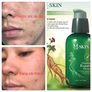 Serum thay da nhân sâm MQ Skin (chính hãng)