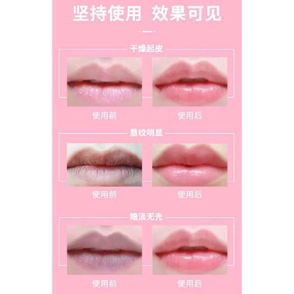 ( Set 3 viên )Tinh Chất Dưỡng Hồng Môi | BigBuy360 - bigbuy360.vn