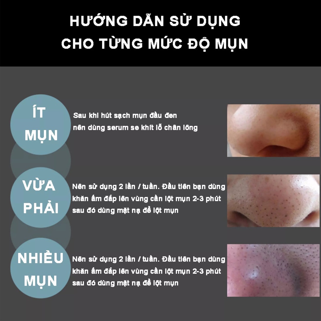 Combo gel lột mụn than tre, than hoạt tính, gel hút mụn Kone + tặng kèm CỌ quét