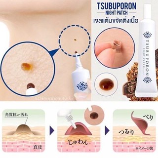 KEM MỜ NỐT RUỒI TSUBUPORON NIGHT PATCH