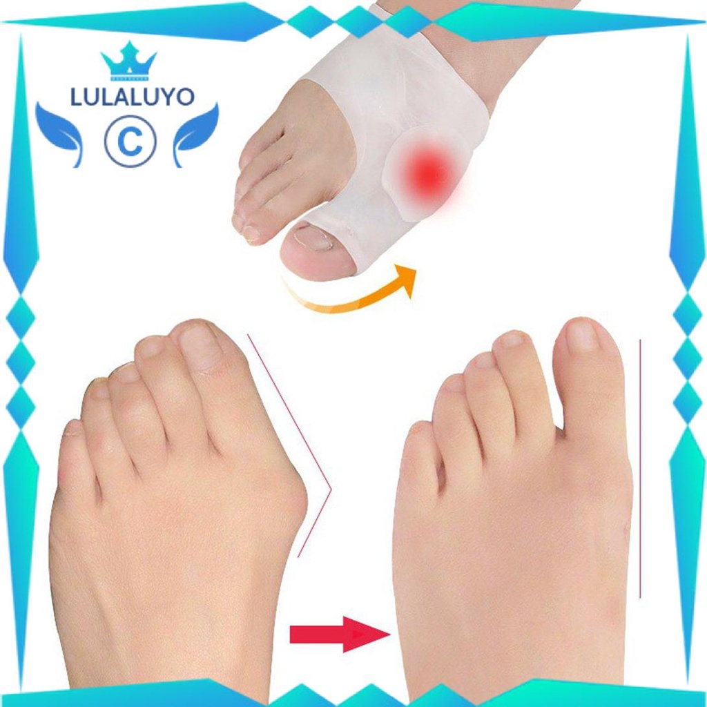 [Giá thấp]  Big toe overlap split toe orthosis hallux valgus separator big toe orthosis split Toe Spacers Toe Splitter  .lu