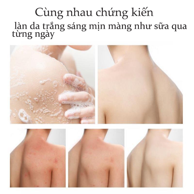 Sữa tắm loại bỏ mụn sữa tắm trắng da 260ml giúp giải quyết tình trạng da khô ngứa kháng khuẩn khử mùi hôi