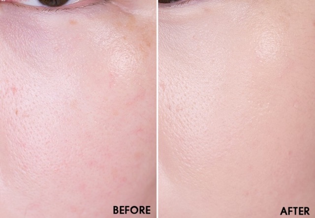 [Chính hãng] Phấn Nước Che Phủ Tốt, Giúp Dưỡng Ẩm Và Làm Dịu Da Some By Mi Killing Cover Moisture Cushion | BigBuy360 - bigbuy360.vn