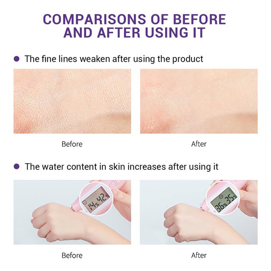 Tinh Chất Việt Quất 5ml Giúp Dưỡng Ẩm Và Làm Sáng Da Cao Cấp